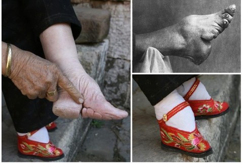 footBinding