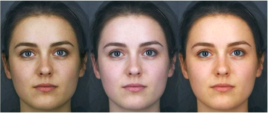 Skin Color Recktangular Shape Teeth: The Mirror of Body’s Health – TMD – Occlusion
